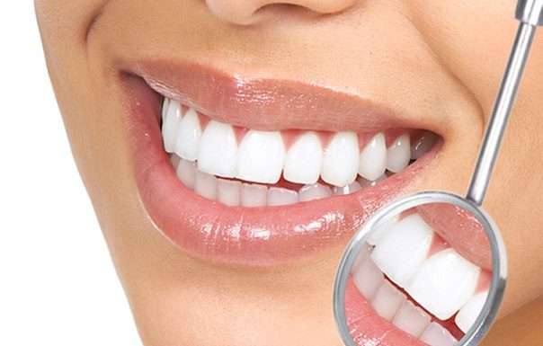 Відбілювання зубів: лише індивідуальне рішення