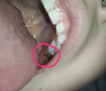 Ріжеться 6. Че робити щось?