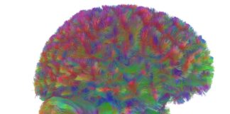 Starzenie się ludzkiego mózgu: nowe badanie identyfikuje pięć odrębnych epok