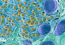 Революційна клітинна терапія відновлює вироблення інсуліну у хворого на діабет 1 типу