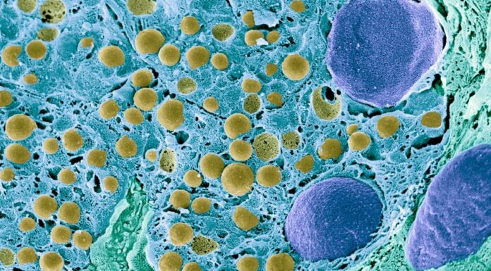 Революційна клітинна терапія відновлює вироблення інсуліну у хворого на діабет 1 типу