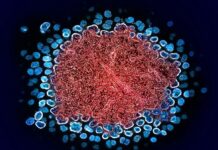 Прорив у ремісії ВІЛ: досягнуто завдяки трансплантації кісткового мозку від рідного брата