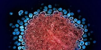 Bahnbrechende HIV-Remission durch Knochenmarkstransplantation bei Geschwistern erreicht